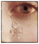 Tear for NO