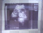 Ashley's baby